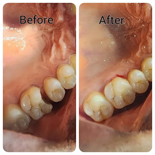 Pooja Smile Care Dental Gallery Image 11